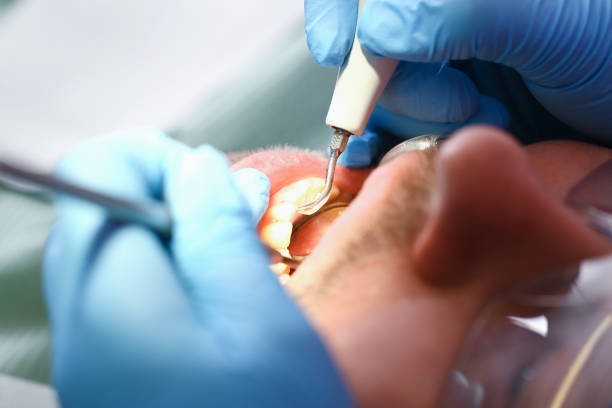 Best Urgent Dental Care in Forest City, FL