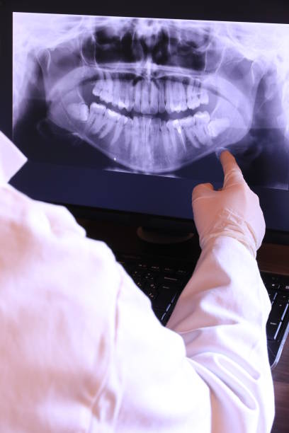 Best Emergency Treatment for Toothache in Forest City, FL