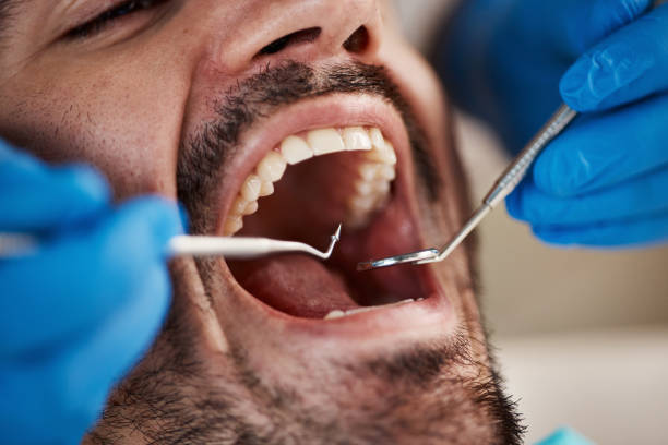 Best Emergency Broken Tooth Repair in Forest City, FL
